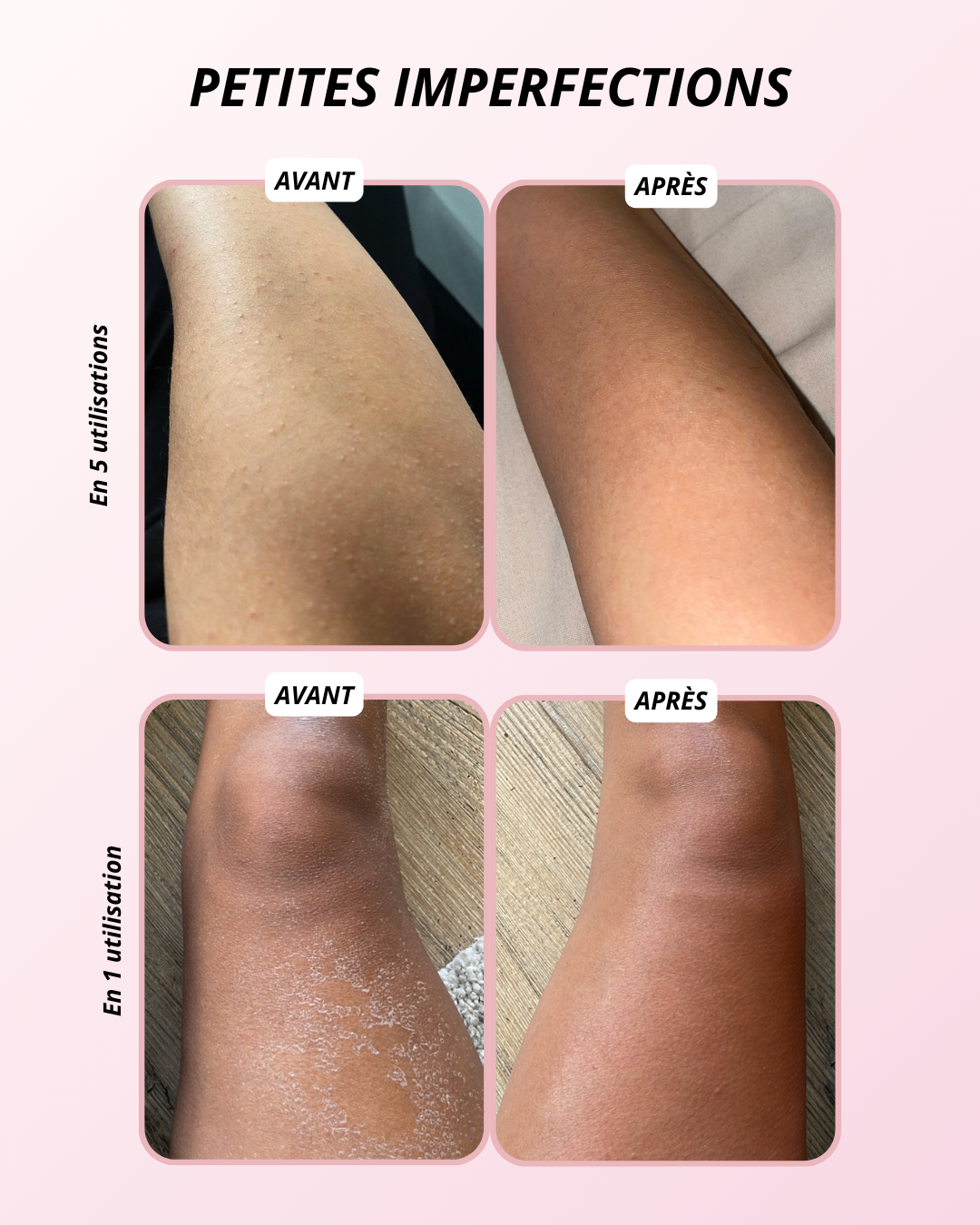 Coffret Anti-Imperfections - Corps