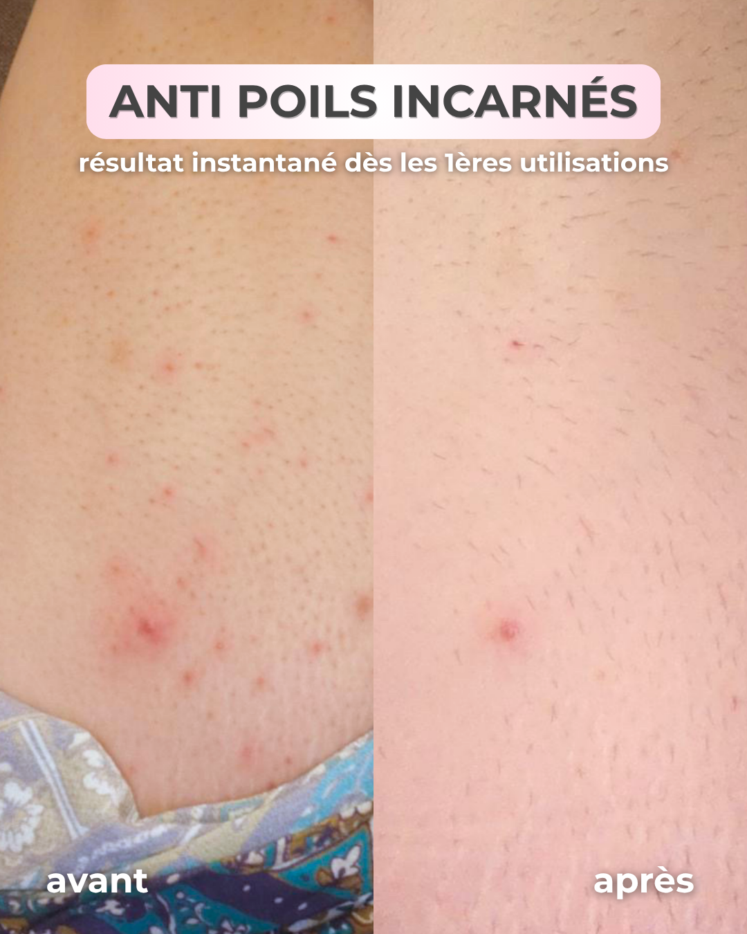 Gant Exfoliant en Soie Corps